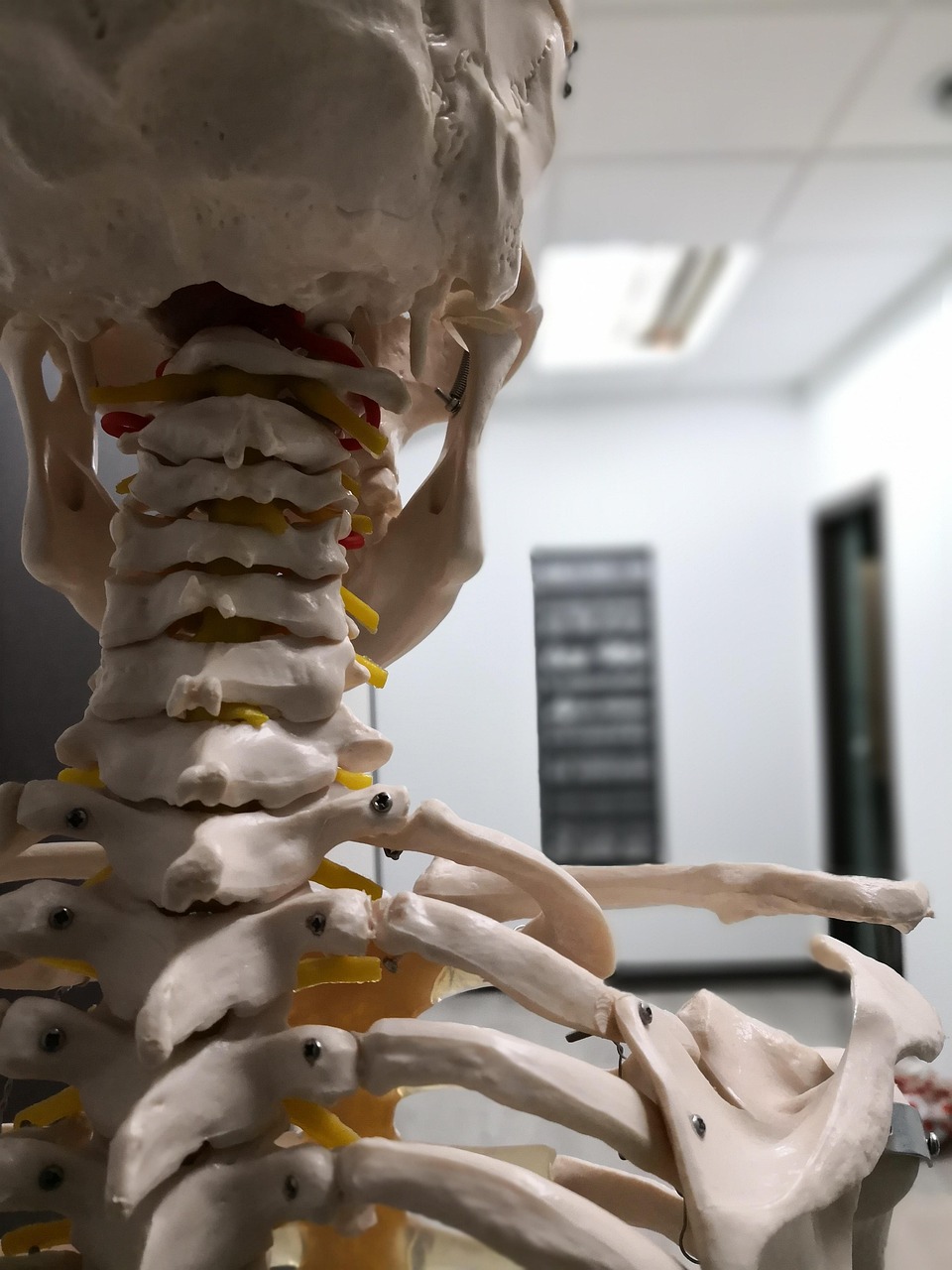 Sciatique : comprendre la douleur et les options de prise en charge